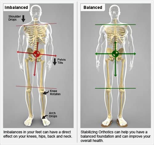 short leg correction before and after body diagram